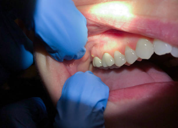 Best Orthodontic Emergency Dentist in Richmond, IL