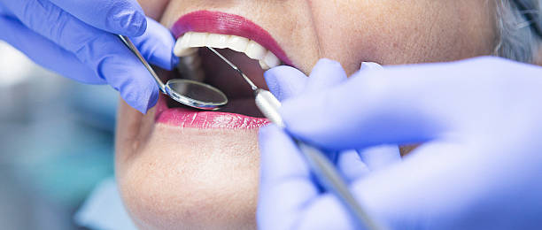 Best Emergency Dentist for Knocked-Out Tooth in Richmond, IL